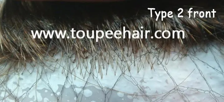 vorderer Haaransatz Typ 2